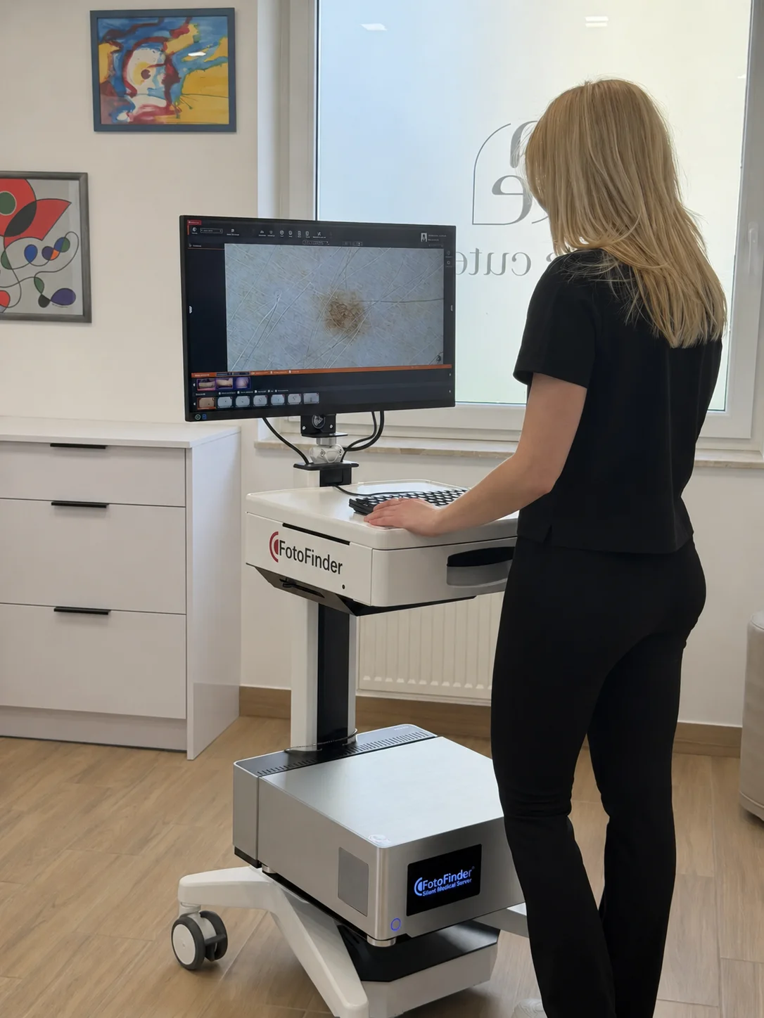 Dermatolog De Cute analizuje obraz znamienia w systemie FotoFinder.